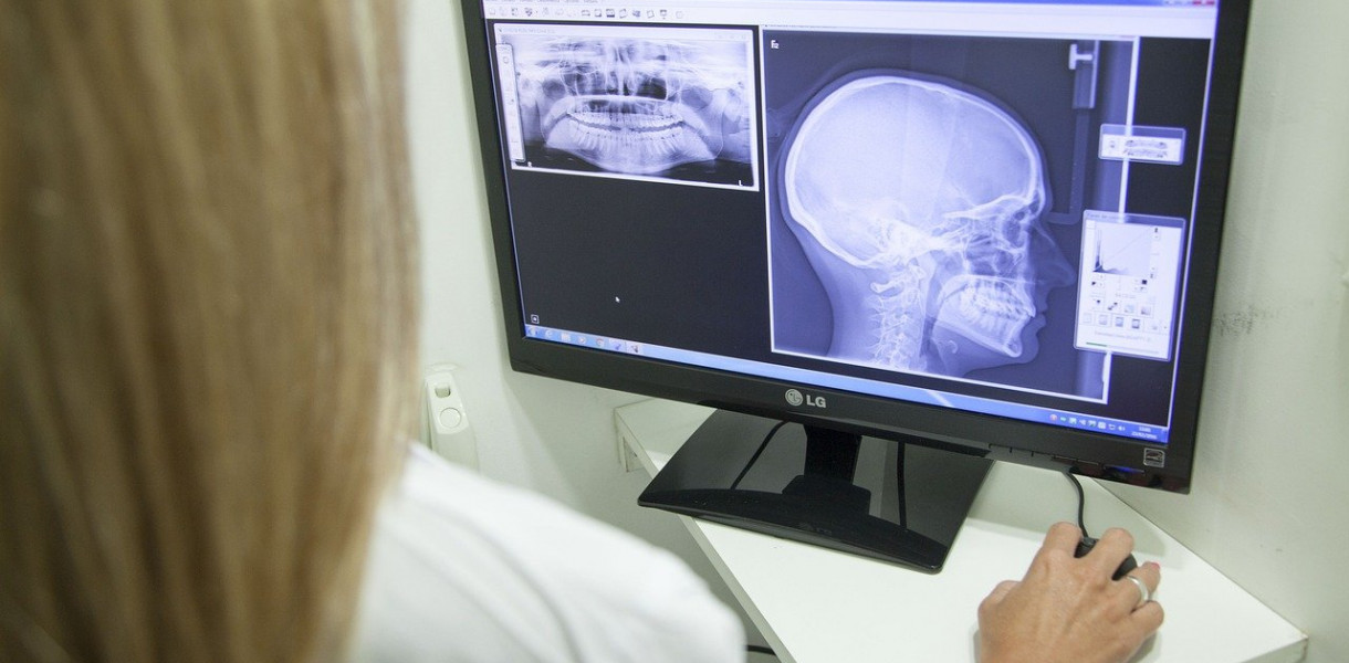 Nowy Szpital w Świeciu kupił nowy aparat rentgenowski. Właśnie rusza remont pracowni, w której będzie działać. Fot. Pixabay